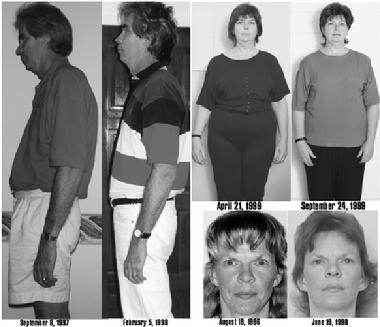 Headaches and Migraines; TMJ and Jaw pain; Sciatica, Scoliosis and Back Pain; Sinusitis, Sleep Apnea, Snoring, Breathing and Sinus Disorders; Concussion and other Head Injuries; Whiplash syndrome; Cerebral Palsy and other chronic conditions. NeuroCranial Restructuring may help a wide range of symptoms including � Acute and Chronic Ostitis Media, Alzheimer�s Disease, Amyotrophic Lateral Sclerosis (ALS), Anxiety and Nervousness, Arthritis, Bursitis, Rheumatism, Attention Deficit Disorder (ADD), Autism, Bipolar Disorder, Brain Surgery, Bruxism, Cerebral Palsy, Chronic Fatigue, Concussion, Deafness, Depression, Double Vision, Down Syndrome, Dyslexia, Dystonia, Ear infections Fibromyalgia Glaucoma Head injuries, Hyperactivity, Insomnia, Kyphosis(Hunchback), Disabilities Lordosis(Swayback) Lou Gehrig�s Disease Low Energy, Lymphatic Toxins, Lymphoma, Manic Depression, Migraines, Military Spine, Multiple Sclerosis, Muscle Spasms, Neck Pain, Obsessive Compulsive Disorder(OCD), Orthodontic Stress, Osteoporosis, Parkinson�s Disease, Phobias, Polio, Poor Concentration, Psychosis, Relationship, Difficulties Schizophrenia Sciatica Scoliosis and Spiral Spine, miners, Seizures Shoulder and Neck Pain, Sinus Disorders, Sinusitis, Sleep Apnea, Snoring, Strokes, Teeth Grinding, Tinnitus, TMJ (Temporomandibular joint) and TMD (Temporomandibular Disc), Vertigo and Balance Problems, Whiplash Headaches, � Alzheimer�s?, � Anxiety and nervousness? Arthritis, bursitis and rheumatism? � Attention Deficit Disorder, dyslexia, hyperactivity, disabilities?, � Autism?, � Brain surgery?, � Cerebral palsy?, � Bipolar disorder, (Manic-depression)?, Depression?, Obsessive-compulsive disorder?, � Psychosis? Schizophrenia?, � Concussion and other head injuries?, � Down�s Syndrome?, � Dystonia?, � Ear infection (acute and chronic otitis media) and deafness?, � Forty-seven chromosome individuals?, � Glaucoma? Double vision? Other vision problems?, � Headaches, head pressure, migraines?, � Heart conditions?, � Insomnia?, � Low energy (fibromyalgia, chronic fatigue)?, � Lymphatic circulation and its malfunctioning, such as lymphoma, lymphatic?, toxins, Lymphoid?, � TMD or TMJ (Mouth, head and jaw pains)?, � Multiple sclerosis and amyotrophic lateral sclerosis (Lou Gehrig�s disease)?, � Muscular dystrophy?, � Muscle spasms? Neck and shoulder pain?, � Organ functioning?, � Orthodontic stress and bruxism (grinding)?, � Osteoporosis?, � Para- and quadriplegics?, � Parkinson�s disease and tremors?, � Phobias?, � Polio?, � Poor concentration and focus?, � Relationship difficulties?, � Sciatica, kyphosis (hunchback), lordosis (swayback), scoliosis (a spiral spine), military spine (from whiplash) and other back problems?, � Seizures?, � Sinusitis? Sleep apnea? Snoring? Breathing and sinus disorders?, � Strokes? Thrombosis (excessive blood clotting)?, � Left hemisphere paresis?, � Tinnitus?, � Tuberculosis?, Vertigo and other balance problems?, � Autism, � Cerebral palsy, � Concussion and other head injuries, � Depression, obsessive-compulsive disorder, � Down�s Syndrome, � Dystonia, � Ear infection and deafness, � Glaucoma, double vision and other vision problems, � Headaches, head pressure, migraines � Insomnia, � Low energy, Fibromyalgia, chronic fatigue, � Muscle spasms, neck and shoulder pain, � Organ functioning, � Orthodontic stress and bruxism, � Osteoporosis, � Parkinson�s disease and tremors, � Phobias, � Poor concentration and focus, � Relationship difficulties, � Sciatica, kyphosis (hunchback), lordosis (swayback), scoliosis (spiral spine), military spine & other problems, � Seizures, � Sinusitis, sleep apnea, snoring, other breathing and sinus disorders, � Strokes, � Tinnitus, � TMD, TMJ (mouth, head and jaw pains), � Vertigo and other balance problems, � Whiplash Syndrome, � Wrinkles (NeuroCranial Restructuring replaces a face lift)